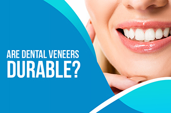 Are Dental Veneers Durable?