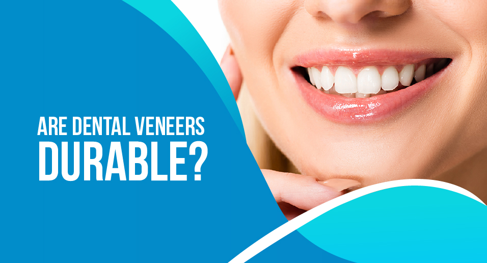 Are Dental Veneers Durable?