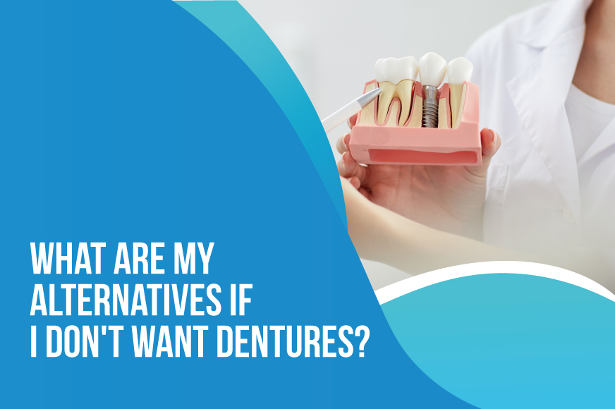 What are my alternatives if I don't want dentures?